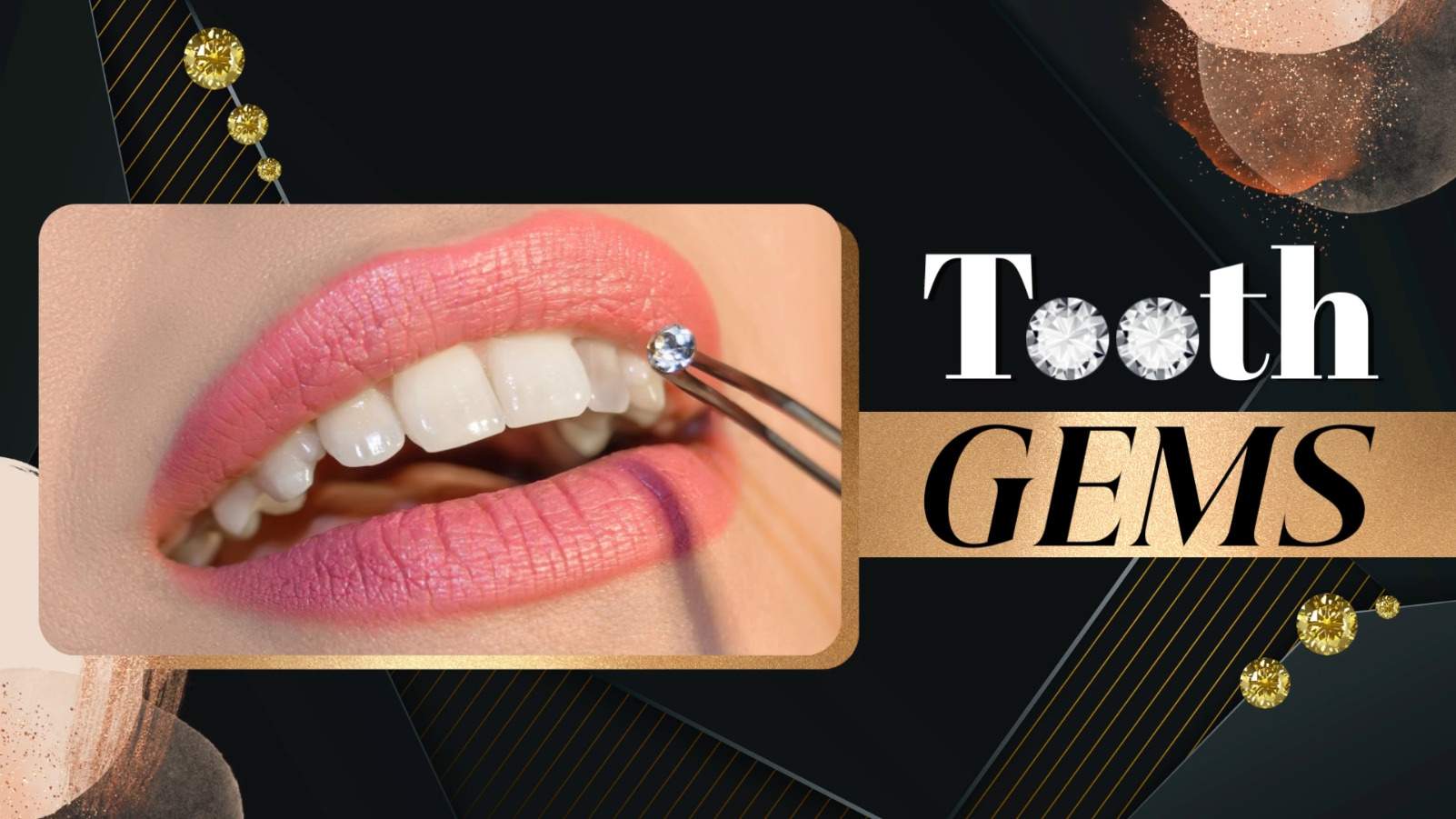 Tooth Gems-Nails-N-CV