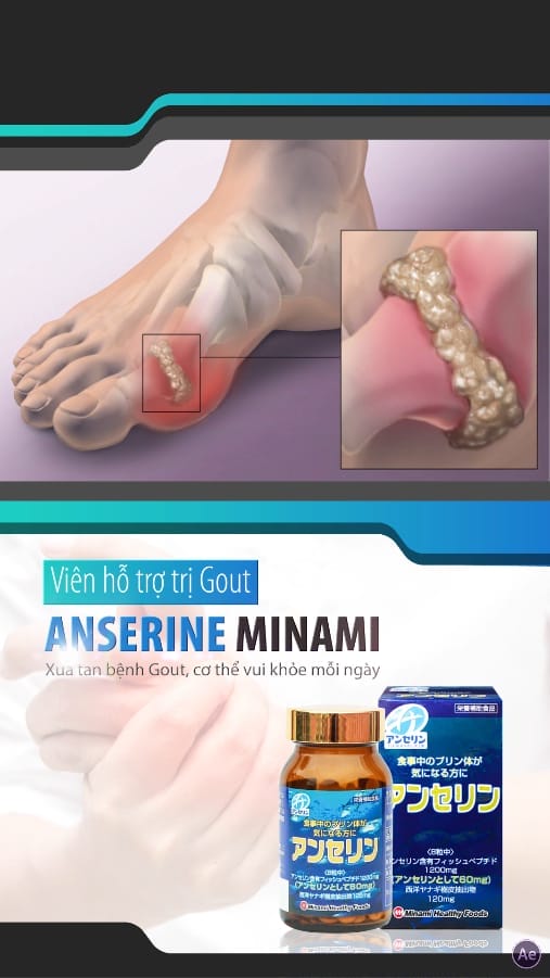 Viên hỗ trợ trị Gout ANSERINE MINAMI